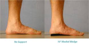 medial heel wedge